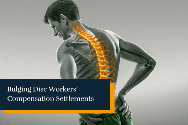 a 3D illustration of a man with back pain because of a bulging disc